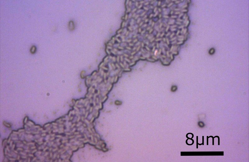 bacillus-clausii-enterogermina-gastrite